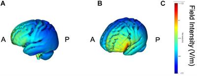 Pre-stimulus Brain Activity Is Associated With State-Anxiety Changes During Single-Session Transcranial Direct Current Stimulation